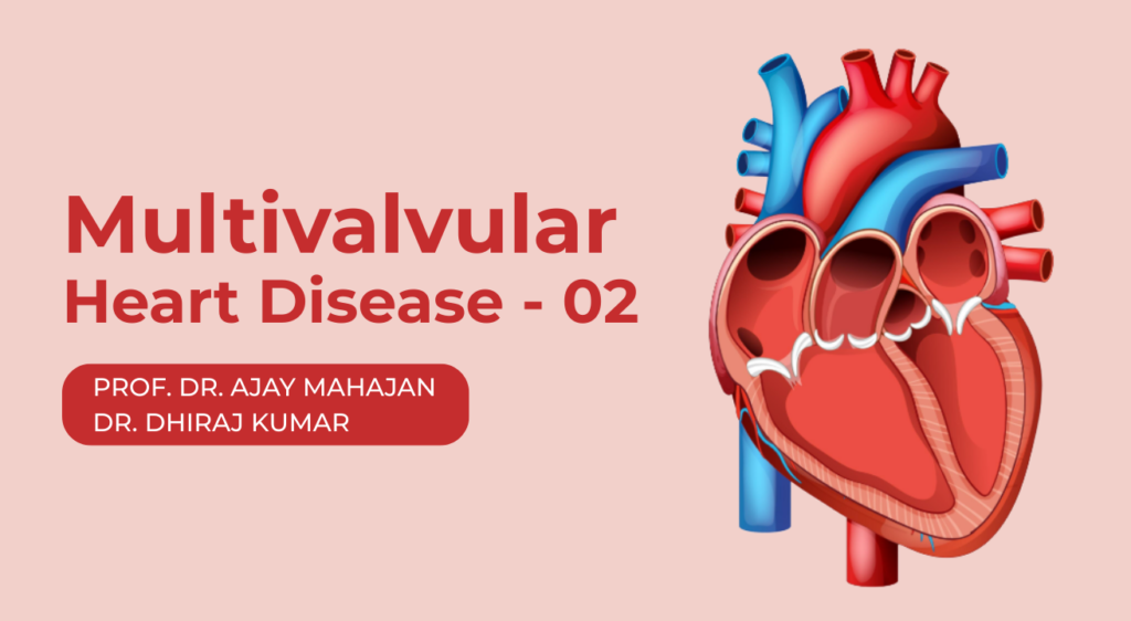 Multivalvular Heart Disease- 02