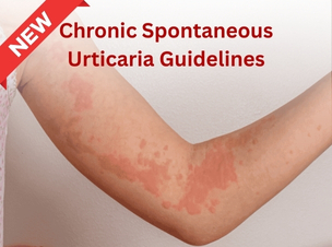 Chronic spontaneous urticaria guidelines: What is new?
