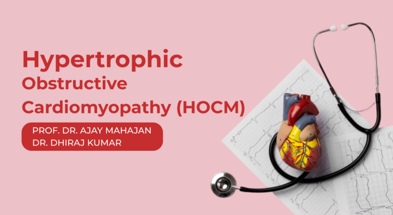 Hypertrophic Obstructive Cardiomyopathy (HOCM)