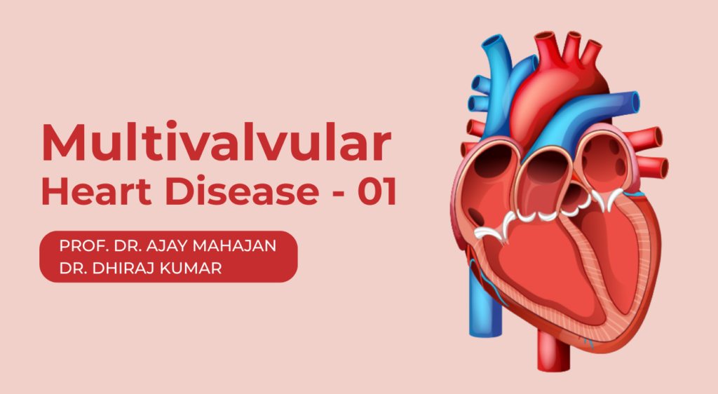 Multivalvular Heart Disease – 01