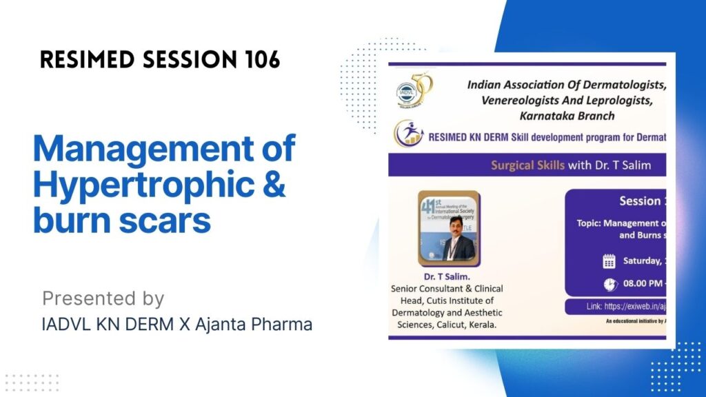 Resimed 106 | Management of Hypertrophic and Burn scars
