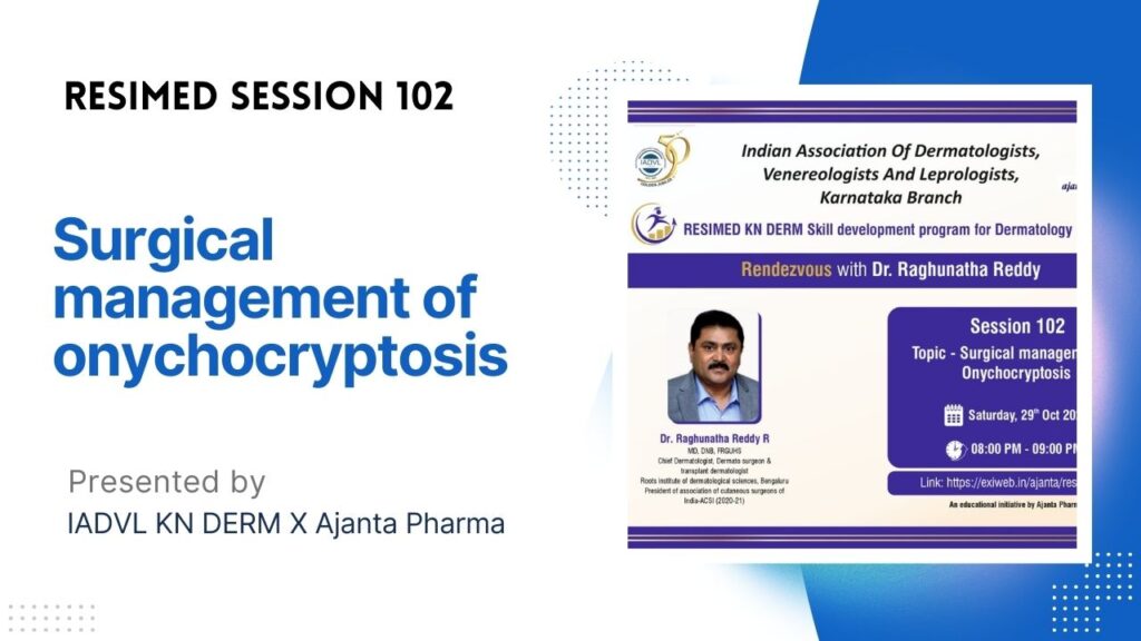 Resimed 102 | Surgical management of Onychocryptosis