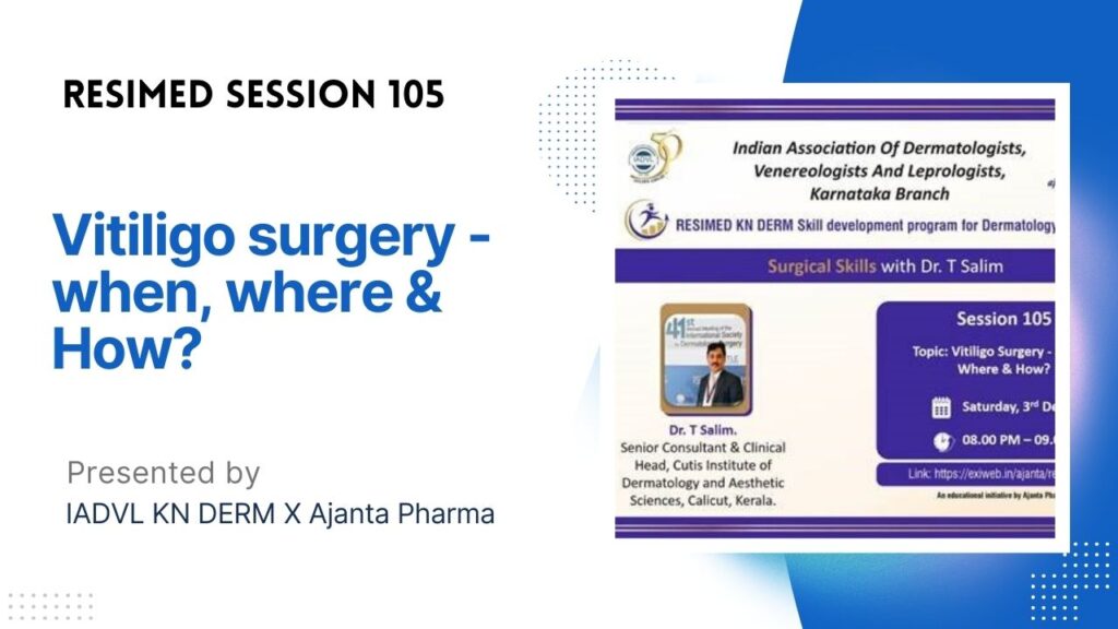 Resimed 105 | Vitiligo Surgery – When, Where & How?