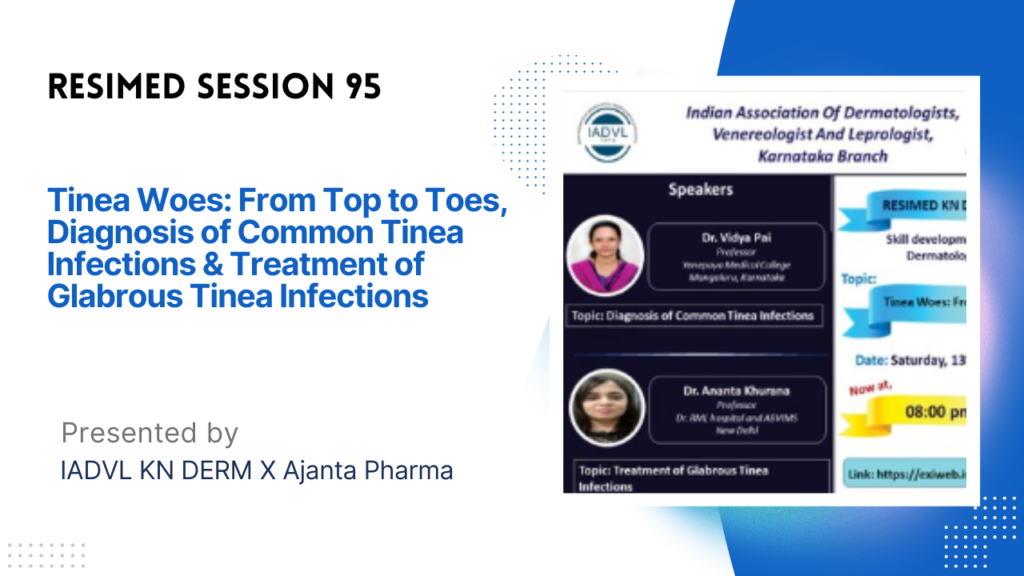 Resimed 95 | Tinea Woes: From Top to Toes, Diagnosis of Common Tinea Infections & Treatment of Glabrous Tinea Infections