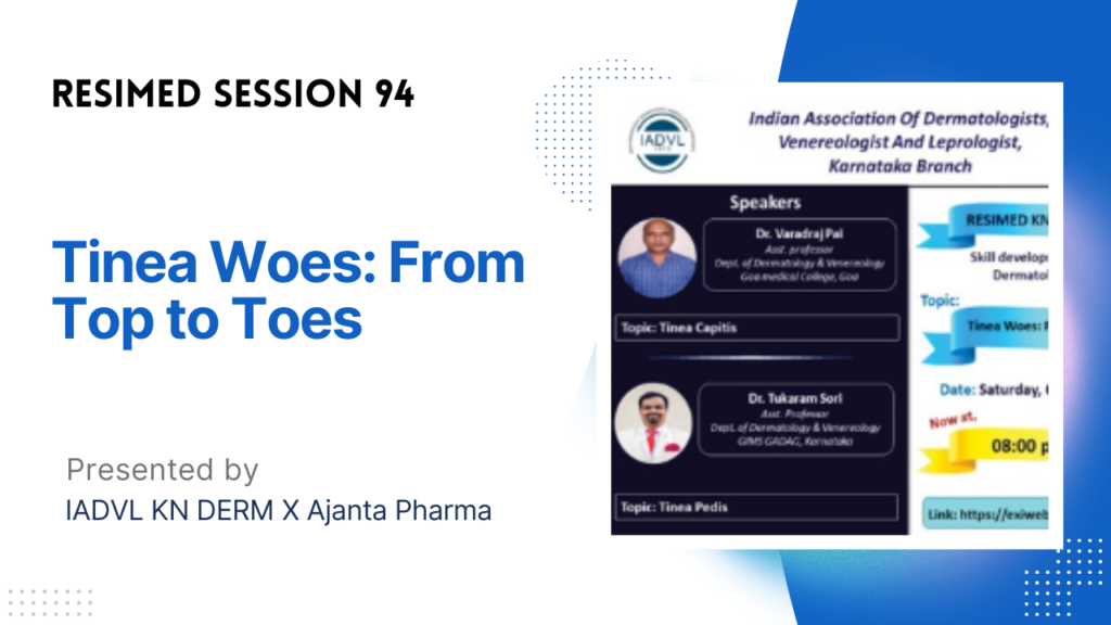 Resimed 94 | Tinea Woes: From Top to Toes