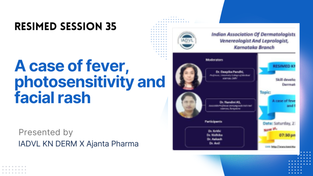 Resimed 35 | A case of fever, photosensitivity & facial rash