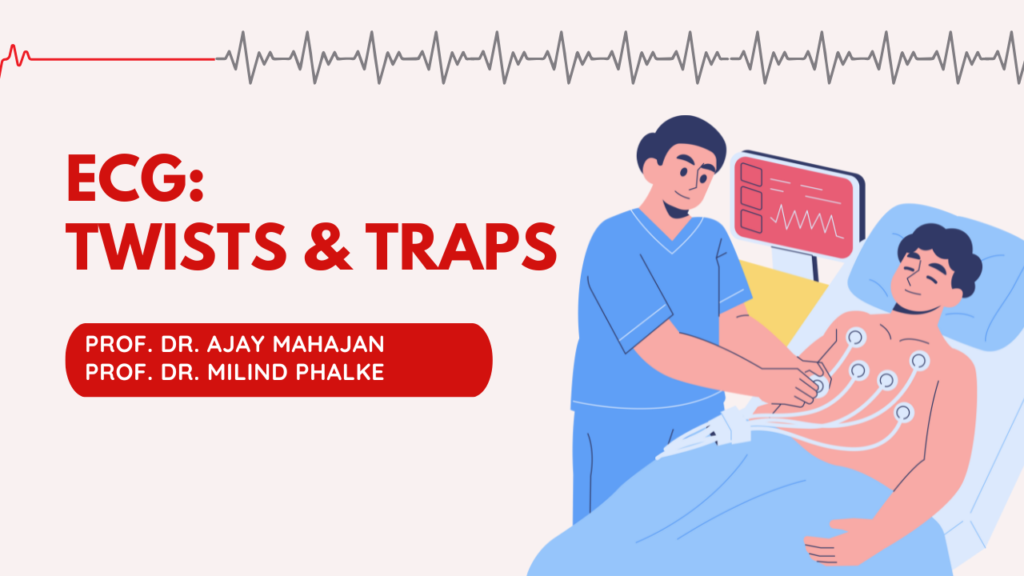 ECGs Twists & Traps
