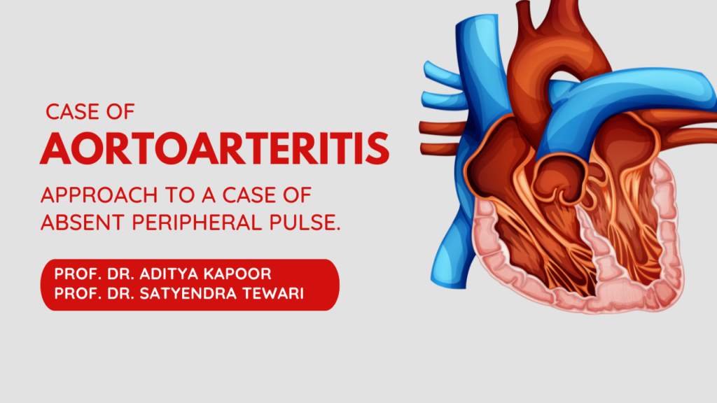 Case of aortoarteritis: Approach to a case of Absent peripheral Pulse.